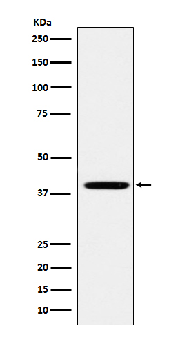 WB - Anti-FOLR1 Rabbit Monoclonal Antibody ABO15183